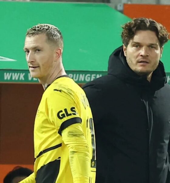 Dortmund Manager Terzic Optimistic For UCL Turnaround Despite Injuries