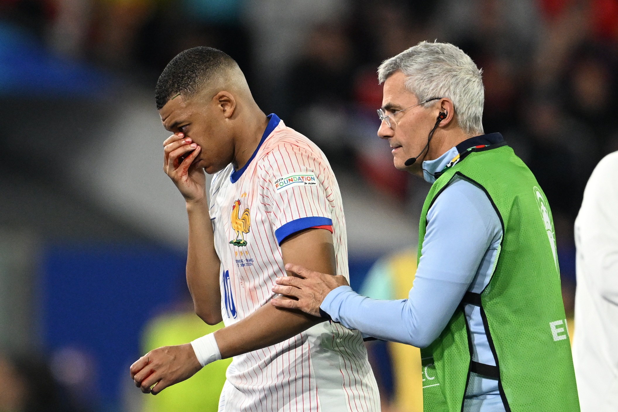 Euro 2024: Kylian Mbappé Set To Miss Next France Game