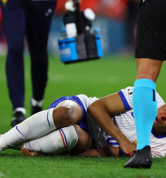 Kylian Mbappe Sustains Broken Nose In France Won Over Austria