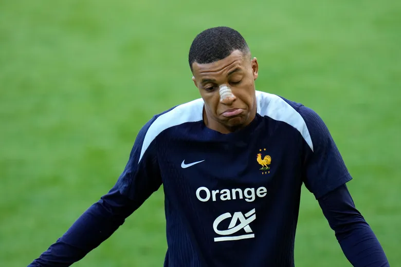 Euro 2024: Kylian Mbappe Returns To France Training With Bandage On Nose