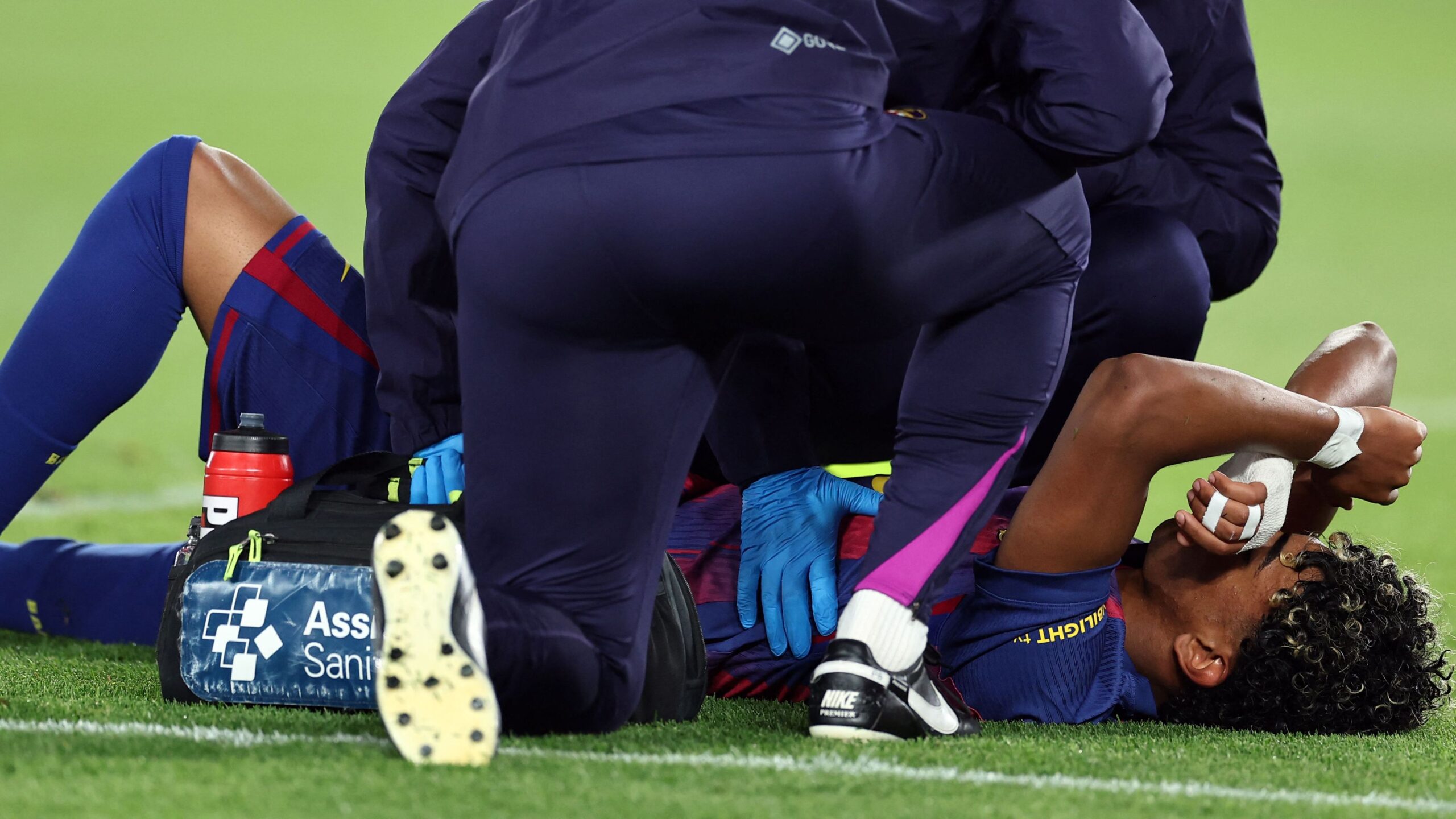 FC Barcelona has officially confirmed that Lamine Yamal sustained a hamstring injury in his left leg (specifically the biceps femoris muscle) during the team's 1–0 victory over Celta Vigo on Wednesday, April 22, 2026.
